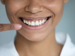 Gingivectomía estética: ¿Cómo recortar la encía?