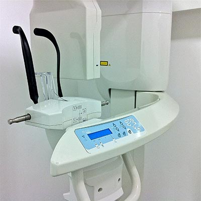 analisis-3d-implantes