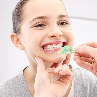 brackets-esteticos