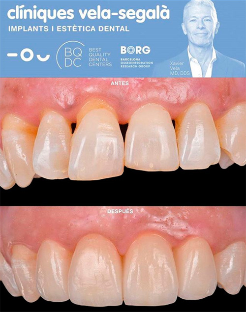 caso-clinico-paciente-periodontal