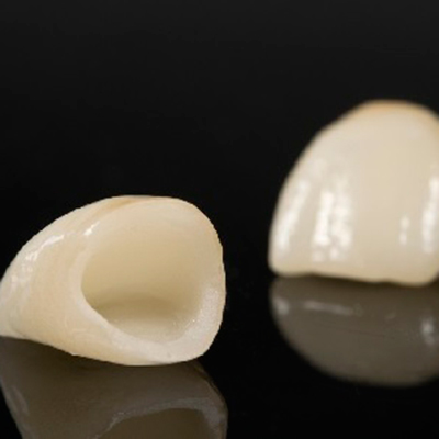 fundas-dentales