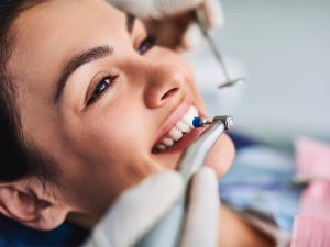 ¿La limpieza dental daña los dientes?