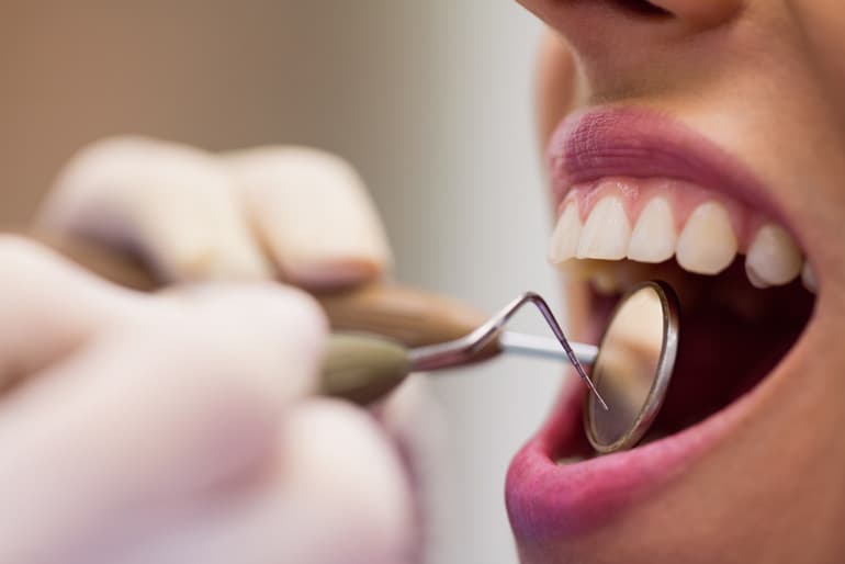 prevencion de la periodontitis cuidados bucales