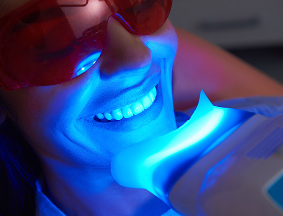 Proceso blanqueamiento dental